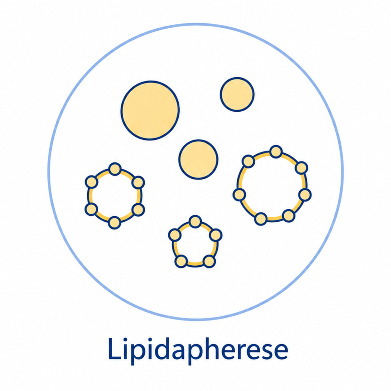 Lipidapherese